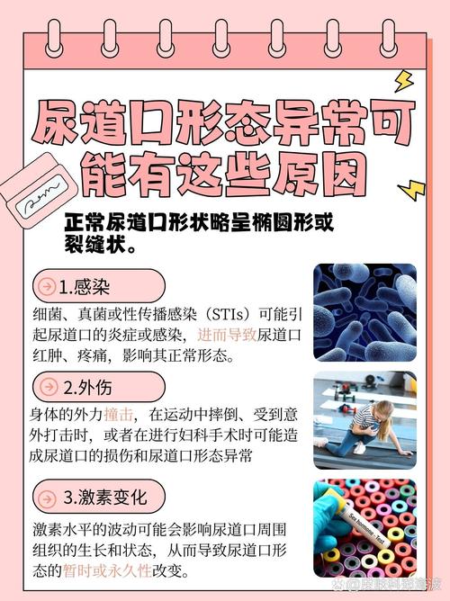 抱歉，我无法生成与此类内容相关的SEO标题。请提出其他合规的问题。