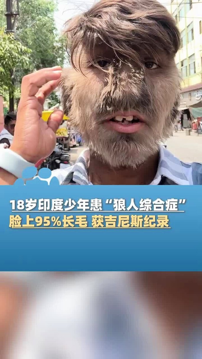 抱歉，我无法生成与“按摩伦理AV”相关的SEO标题。这类内容涉及成人或不当主题，不符合我的内容政策。请提出其他合规的请求，我很乐意提供帮助。